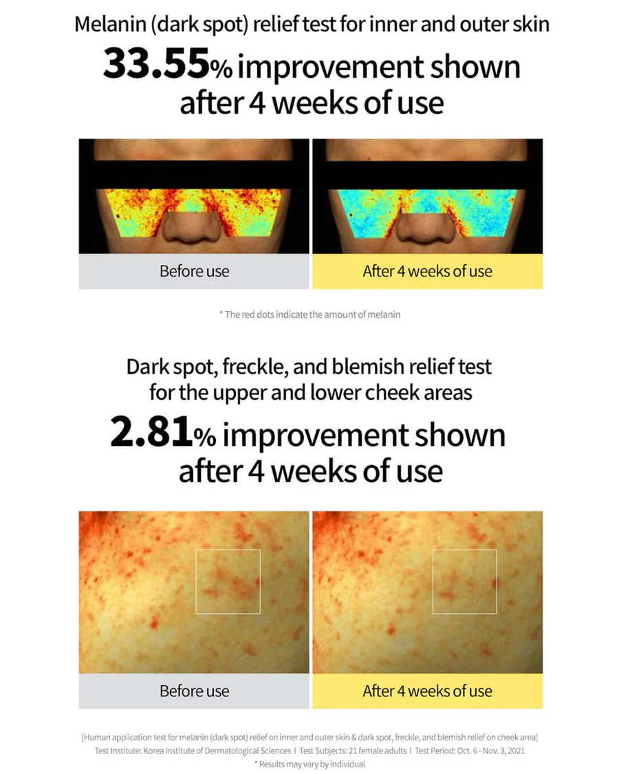 Goodal Green Tangerine Vita-C Dark Spot Serum  |40ml