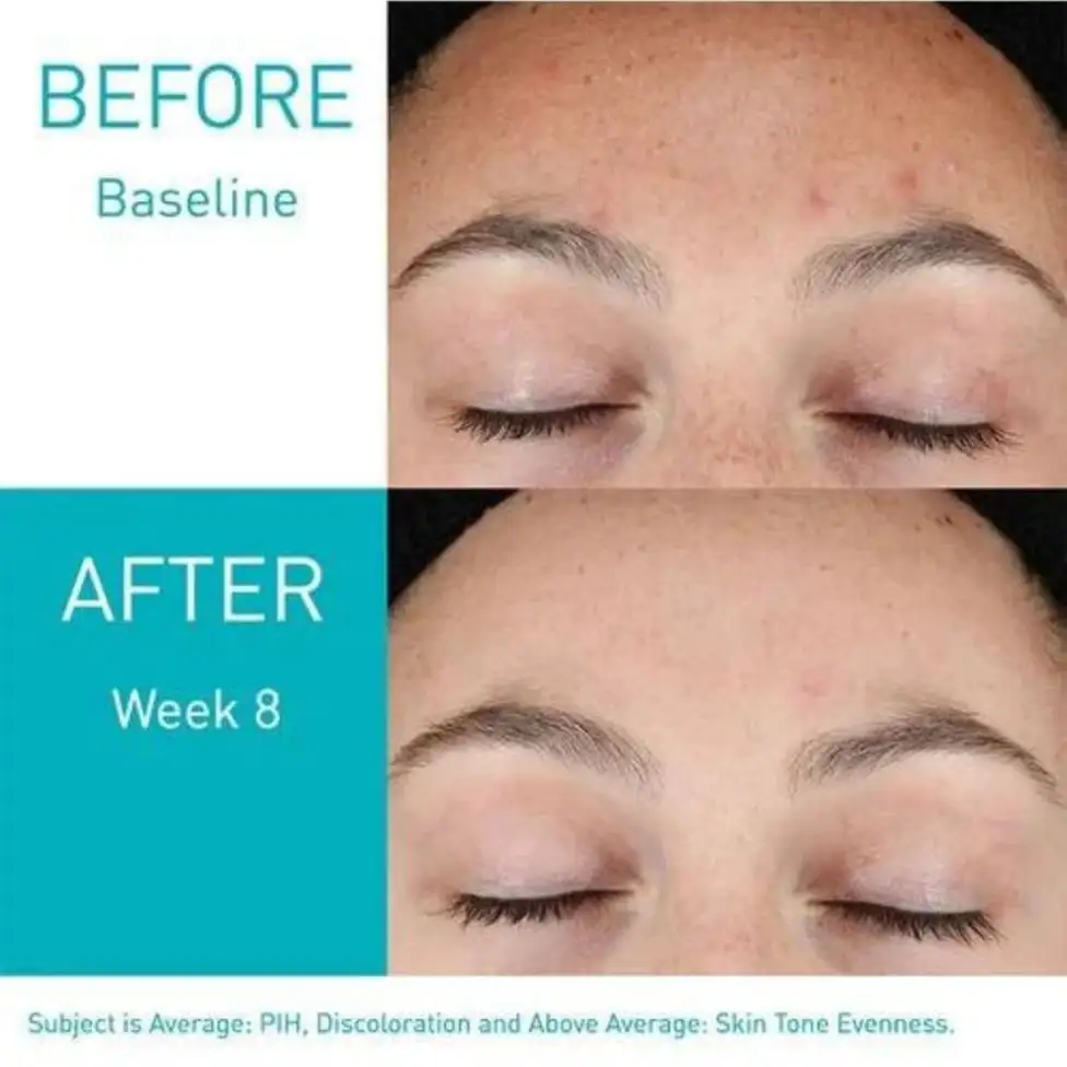 CeraVe Resurfacing Retinol Serum  |30ml